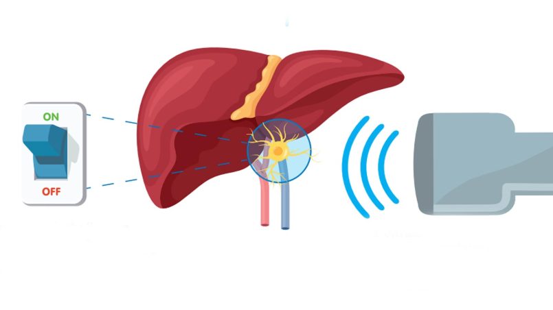 Diabetes Berjaya Dirawat Menggunakan Sistem Ultrasonik Dalam Ujian Makmal