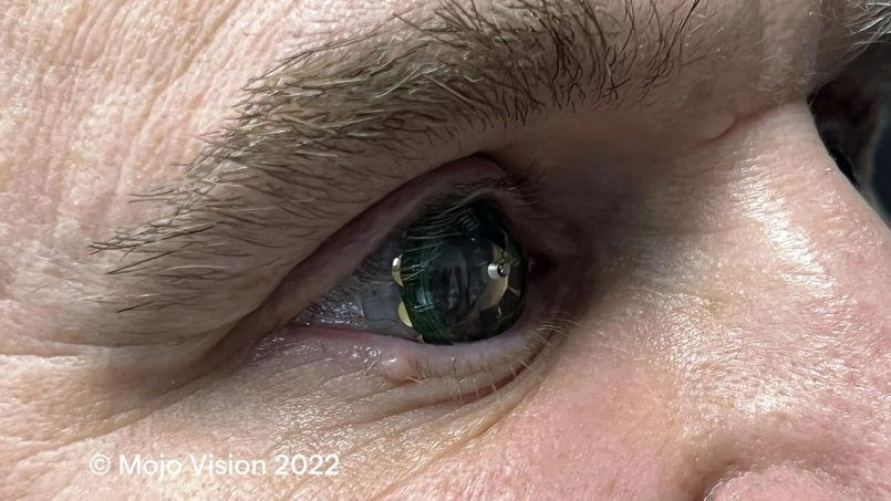 Mojo Vision Memperlihatkan Kanta Lekap AR Yang Berfungsi Sepenuhnya